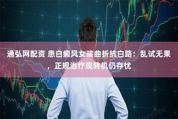 通弘网配资 患白癜风女孩曲折抗白路:乱试无果,正规治疗现转机仍存忧
